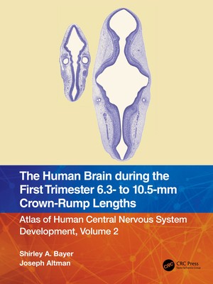 The Human Brain During the First Trimester 6.3- To 10.5-MM Crown-Rump…